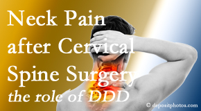 Lombardy Chiropractic Clinic offers gentle care for neck pain after neck surgery.