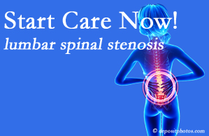 Lombardy Chiropractic Clinic presents research that emphasizes that non-operative treatment for spinal stenosis within a month of diagnosis is beneficial. 