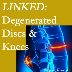 Degenerated discs and degenerated knees are not such unlikely companions. They are seen to be related. Augusta patients with a loss of disc height due to disc degeneration often also have knee pain related to degeneration. 