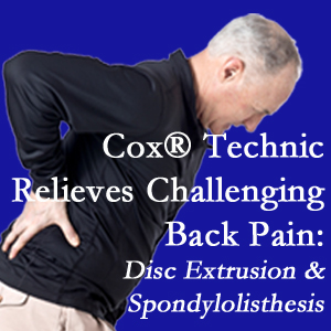 Augusta chiropractic care with Cox Technic relieves back pain due to a painful combination of a disc extrusion and a spondylolytic spondylolisthesis.
