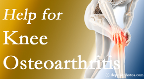 Lombardy Chiropractic Clinic shares recent studies regarding the exercise suggestions for knee osteoarthritis relief, even exercising the healthy knee for relief in the painful knee!