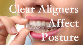 Clear aligners influence posture which Augusta chiropractic helps.