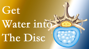 Lombardy Chiropractic Clinic uses spinal manipulation and exercise to enhance the diffusion of water into the disc which supports the health of the disc.