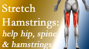 Lombardy Chiropractic Clinic encourages back pain patients to stretch hamstrings for length, range of motion and flexibility to support the spine.