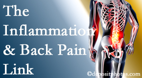 Lombardy Chiropractic Clinic addresses the inflammatory process that accompanies back pain as well as the pain itself.