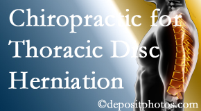 Lombardy Chiropractic Clinic diagnoses and treats thoracic disc herniation pain and relieves its symptoms like unexplained abdominal pain or other gastrointestinal issues.