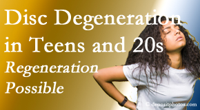 Lombardy Chiropractic Clinic relieves back pain due to disc degeneration in younger people in their teens and 20s.