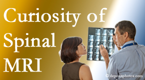 Augusta MRIs for spinal stenosis may be revealing…or puzzling.