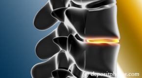 Augusta degenerative spinal changes
