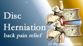 Lombardy Chiropractic Clinic uses non-surgical treatment for relief of disc herniation related back pain. 
