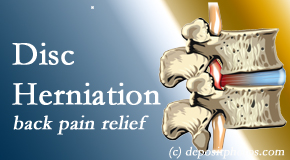 Lombardy Chiropractic Clinic uses non-surgical treatment for relief of disc herniation related back pain.