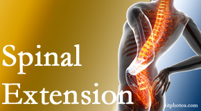 Lombardy Chiropractic Clinic understands the role of extension in spinal motion, its necessity, its benefits and potential harmful effects. 