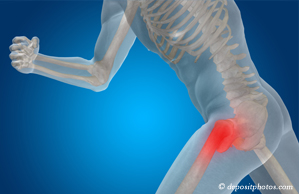 image of hip