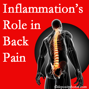 The role of inflammation in Augusta back pain is real. Chiropractic care can manage it.