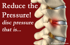 image of Augusta disc herniation