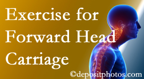 Augusta chiropractic treatment of forward head carriage is two-fold: manipulation and exercise.
