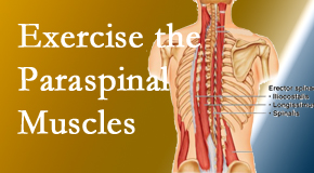 Lombardy Chiropractic Clinic describes the importance of paraspinal muscles and their strength for Augusta back pain relief.