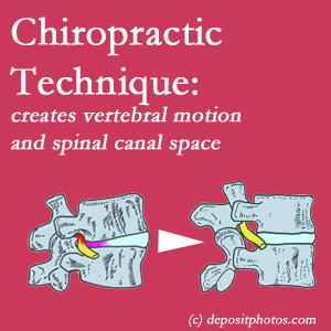 picture of a Augusta spinal stenotic canal