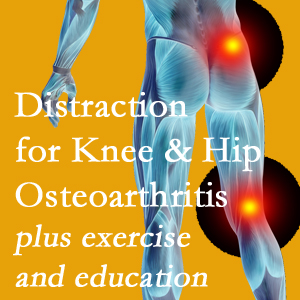 A chiropractic treatment plan for Augusta knee pain and hip pain caused by osteoarthritis: education, exercise, distraction.