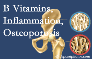 Augusta chiropractic care of osteoporosis often comes with nutritional tips like b vitamins for inflammation reduction and for prevention.