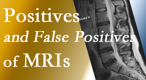 Lombardy Chiropractic Clinic carefully decides when and if MRI images are needed to guide the Augusta chiropractic treatment plan.