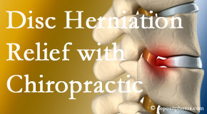 Lombardy Chiropractic Clinic gently treats the disc herniation causing back pain. 